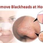 Most Advanced Products To Remove Blackheads At Home