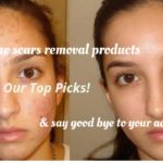 best products for acne scars