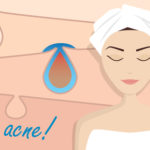 Best Acne Treatment For Dry Skin