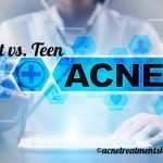 Difference between teen and adult acne